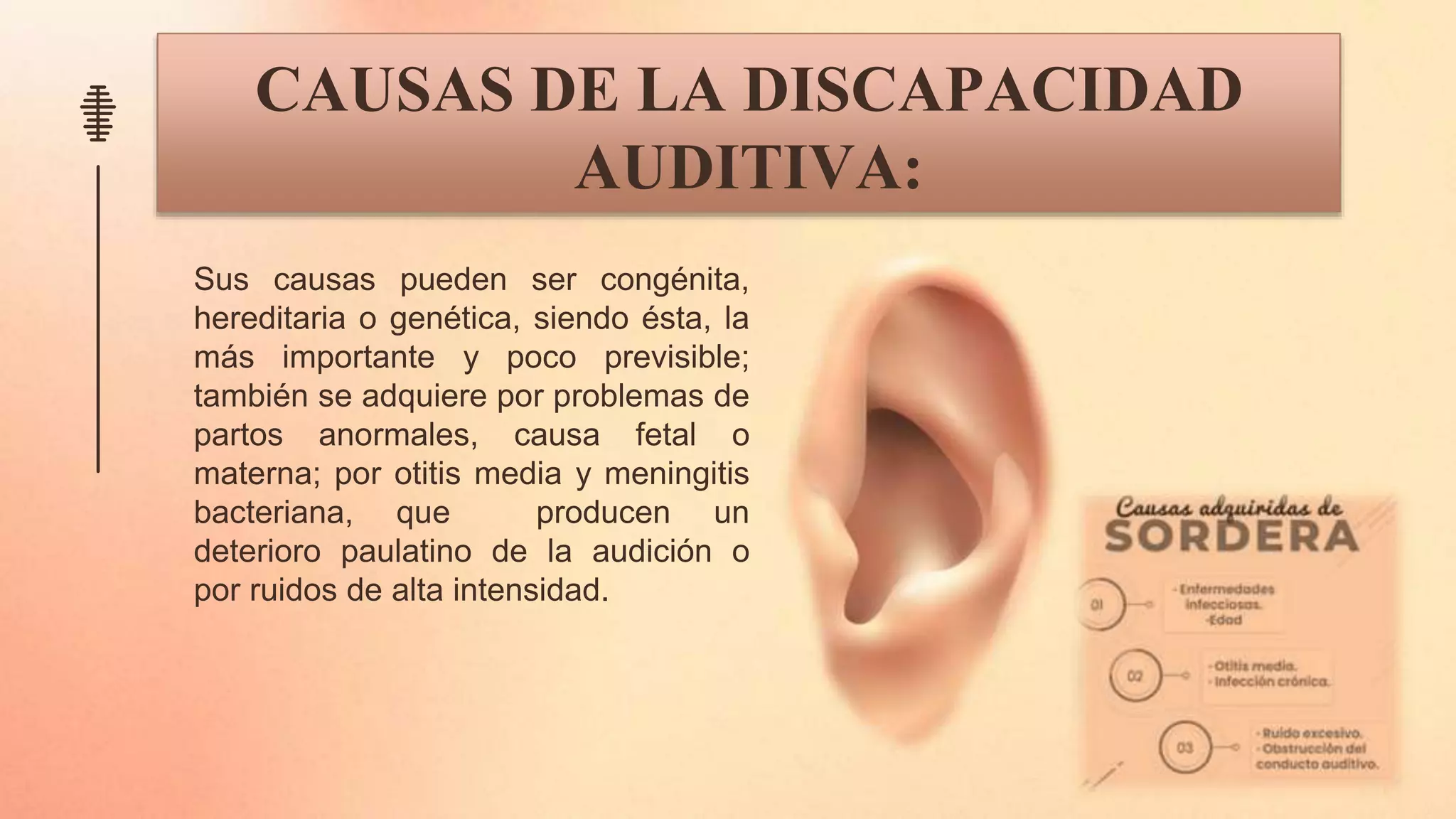 DISCAPACIDAD AUDITIVA