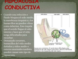 • Cuando una infección o
  fluido bloquea el oído medio,
  la membrana timpánica y los
  huesecillos no pueden vibrar
  como deberían. Esto impide
  que el sonido llegue al oído
  interno y hace que el niño
  tenga dificultades para
  escuchar.
• Demasiado cerumen,
  huesecillos del oído medio
  dañados y oídos medio o
  externo anormales también
  pueden causar este tipo de
  hipoacusia.
 