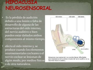 • Es la pérdida de audición
  debido a una lesión o falta de
  desarrollo de alguna de las
  estructuras del oído interno,
  del nervio auditivo o bien
  pueden estar dañados ambos
  componentes al mismo tiempo.

• afecta al oído interno y, se
  produce cuando los elementos
  neurosensoriales cocleares o el
  nervio coclear se lesionan de
  algún modo, por medios físicos
  o de otra naturaleza.
 