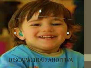 DISCAPACIDAD AUDITIVA
 