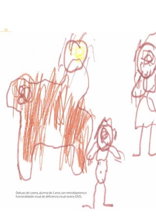 12




     Debuxo de Lorena, alumna de 5 anos con retinoblastoma e
     funcionalidade visual de deficiencia visual severa (DVS).
 