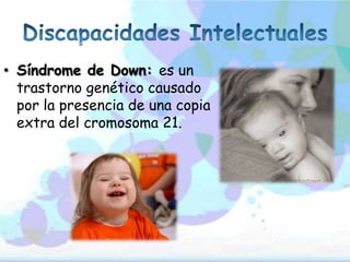 • Síndrome de Down: es un
  trastorno genético causado
  por la presencia de una copia
  extra del cromosoma 21.
 