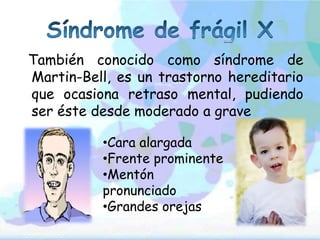 También conocido como síndrome de
Martin-Bell, es un trastorno hereditario
que ocasiona retraso mental, pudiendo
ser éste desde moderado a grave

          •Cara alargada
          •Frente prominente
          •Mentón
          pronunciado
          •Grandes orejas
 