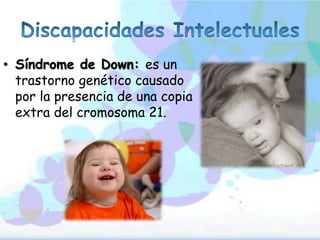 • Síndrome de Down: es un
trastorno genético causado
por la presencia de una copia
extra del cromosoma 21.
 