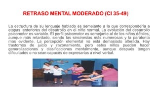 La estructura de su lenguaje hablado es semejante a la que correspondería a
etapas anteriores del desarrollo en el niño normal. La evolución del desarrollo
psicomotor es variable. El perfil psicomotor es semejante al de los niños débiles,
aunque más retardado, siendo las sincinesias más numerosas y la paratonía
mas evidente. La percepción elemental no está demasiado alterada. Hay
trastornos de juicio y razonamiento, pero estos niños pueden hacer
generalizaciones y clasificaciones mentalmente, aunque después tengan
dificultades o no sean capaces de expresarlas a nivel verbal.
RETRASO MENTAL MODERADO (CI 35-49)
 
