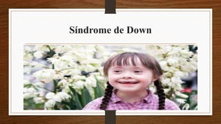 Síndrome de Down
 