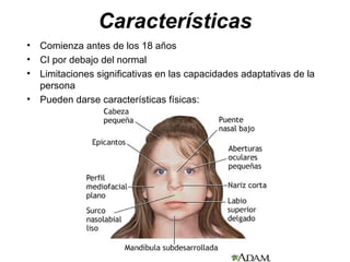 Características
•   Comienza antes de los 18 años
•   CI por debajo del normal
•   Limitaciones significativas en las capacidades adaptativas de la
    persona
•   Pueden darse características físicas:
 