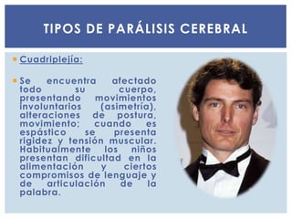  Cuadriplejía:
 Se encuentra afectado
todo su cuerpo,
presentando movimientos
involuntarios (asimetría),
alteraciones de postura,
movimiento; cuando es
espástico se presenta
rigidez y tensión muscular.
Habitualmente los niños
presentan dificultad en la
alimentación y ciertos
compromisos de lenguaje y
de articulación de la
palabra.
TIPOS DE PARÁLISIS CEREBRAL
 
