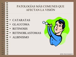 PATOLOGÍAS MÁS COMUNES QUE AFECTAN LA VISIÓN CATARATAS GLAUCOMA RETINOSIS RETINOBLASTOMAS ALBINISMO MGTRA. ITZEL DE GUILBAUTH 
