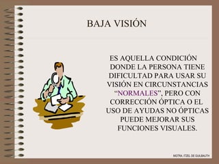 BAJA VISIÓN ES AQUELLA CONDICIÓN DONDE LA PERSONA TIENE DIFICULTAD PARA USAR SU VISIÓN EN CIRCUNSTANCIAS  “ NORMALES ”, PERO CON CORRECCIÓN ÓPTICA O EL  USO DE AYUDAS NO ÓPTICAS PUEDE MEJORAR SUS FUNCIONES VISUALES. MGTRA. ITZEL DE GUILBAUTH 