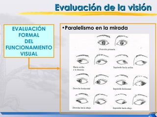 Evaluación de la visión

  EVALUACIÓN      •Paralelismo en la mirada
    FORMAL
      DEL
FUNCIONAMIENTO
     VISUAL
 