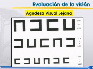 Evaluación de la visión
Agudeza Visual Lejana
 