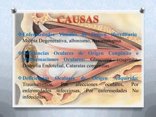 Enfermedades Visuales de Origen Hereditario:
Miopía Degenerativa, albinismo, Acromatopsia.
Deficiencias Oculares de Origen Congénito o
Malformaciones Oculares: Glaucoma congénito,
Distrofia Endotelial, Cataratas congénitas.
Deficiencias Oculares de Origen Adquirido:
Traumatismos, Por afecciones oculares, Por
enfermedades infecciosas, Por enfermedades No
infecciosas.
 