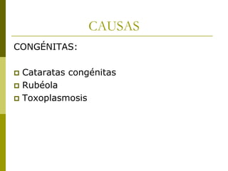 CAUSAS
CONGÉNITAS:
Cataratas congénitas
 Rubéola
 Toxoplasmosis


 