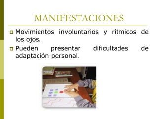 MANIFESTACIONES
Movimientos involuntarios y rítmicos de
los ojos.
 Pueden
presentar
dificultades
de
adaptación personal.


 