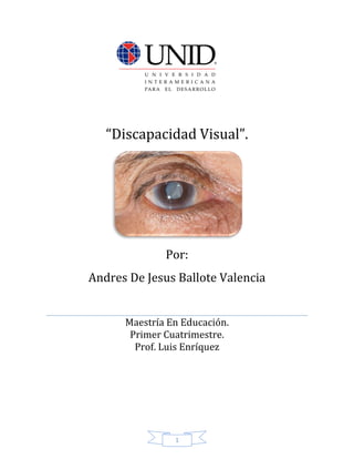 1
“Discapacidad Visual”.
Por:
Andres De Jesus Ballote Valencia
Maestría En Educación.
Primer Cuatrimestre.
Prof. Luis Enríquez
 