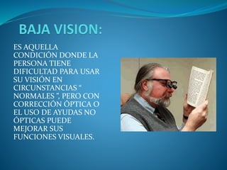 ES AQUELLA
CONDICIÓN DONDE LA
PERSONA TIENE
DIFICULTAD PARA USAR
SU VISIÓN EN
CIRCUNSTANCIAS “
NORMALES ”, PERO CON
CORRECCIÓN ÓPTICA O
EL USO DE AYUDAS NO
ÓPTICAS PUEDE
MEJORAR SUS
FUNCIONES VISUALES.
 