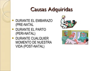 Causas Adquiridas DURANTE EL EMBARAZO (PRE-NATAL DURANTE EL PARTO (PERI-NATAL) DURANTE CUALQUIER MOMENTO DE NUESTRA VIDA (POST-NATAL) 