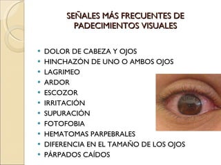 SEÑALES MÁS FRECUENTES DE PADECIMIENTOS VISUALES DOLOR DE CABEZA Y OJOS HINCHAZÓN DE UNO O AMBOS OJOS LAGRIMEO ARDOR ESCOZOR IRRITACIÓN SUPURACIÓN  FOTOFOBIA HEMATOMAS PARPEBRALES DIFERENCIA EN EL TAMAÑO DE LOS OJOS PÁRPADOS CAÍDOS 