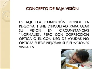 CONCEPTO DE BAJA VISIÓN ES AQUELLA CONDICIÓN DONDE LA PERSONA TIENE DIFICULTAD PARA USAR SU VISIÓN EN CIRCUNSTANCIAS “NORMALES”, PERO CON CORRECCIÓN ÓPTICA O EL CON USO DE AYUDAS NO ÓPTICAS PUEDE MEJORAR SUS FUNCIONES VISUALES. 