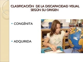 CLASIFICACIÓN  DE LA DISCAPACIDAD VISUAL SEGÚN SU ORIGEN  CONGÉNITA ADQUIRIDA 