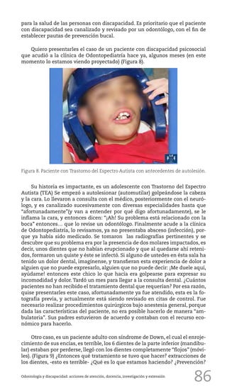86Odontología y discapacidad: acciones de atención, docencia, investigación y extensión
para la salud de las personas con discapacidad. Es prioritario que el paciente
con discapacidad sea canalizado y revisado por un odontólogo, con el fin de
establecer pautas de prevención bucal.
Quiero presentarles el caso de un paciente con discapacidad psicosocial
que acudió a la clínica de Odontopediatría hace ya, algunos meses (en este
momento lo estamos viendo proyectado) (Figura 8).
Figura 8. Paciente con Trastorno del Espectro Autista con antecedentes de autolesión.
Su historia es impactante, es un adolescente con Trastorno del Espectro
Autista (TEA) Se empezó a autolesionar (automutilar) golpeándose la cabeza
y la cara. Lo llevaron a consulta con el médico, posteriormente con el neuró-
logo, y es canalizado sucesivamente con diversas especialidades hasta que
“afortunadamente”(y van a entender por qué digo afortunadamente), se le
inflama la cara, y entonces dicen: “¡Ah! Su problema está relacionado con la
boca” entonces… que lo revise un odontólogo. Finalmente acude a la clínica
de Odontopediatría, lo revisamos, ya no presentaba absceso (infección), por-
que ya había sido medicado. Se tomaron las radiografías pertinentes y se
descubre que su problema era por la presencia de dos molares impactados, es
decir, unos dientes que no habían erupcionado y que al quedarse ahí reteni-
dos, formaron un quiste y éste se infectó. Si alguno de ustedes en ésta sala ha
tenido un dolor dental, imagínense, y transfieran esta experiencia de dolor a
alguien que no puede expresarlo, alguien que no puede decir: ¡Me duele aquí,
ayúdame! entonces este chico lo que hacía era golpearse para expresar su
incomodidad y dolor. Tardó un mes para llegar a la consulta dental. ¿Cuántos
pacientes no han recibido el tratamiento dental que requerían? Por esa razón,
quise presentarles este caso, afortunadamente ya fue atendido, esta es la fo-
tografía previa, y actualmente está siendo revisado en citas de control. Fue
necesario realizar procedimientos quirúrgicos bajo anestesia general, porque
dada las características del paciente, no era posible hacerlo de manera “am-
bulatoria”. Sus padres estuvieron de acuerdo y contaban con el recurso eco-
nómico para hacerlo.
Otro caso, es un paciente adulto con síndrome de Down, el cual el enroje-
cimiento de sus encías, es terrible, los 6 dientes de la parte inferior (mandibu-
lar) estaban por perderse, llegó con los dientes completamente “flojos” (móvi-
les). (Figura 9) ¿Entonces qué tratamiento se tuvo que hacer? extracciones de
los dientes, -esto es terrible- ¿Qué es lo que estamos haciendo? ¿Prevención?
 