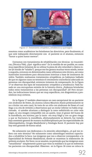 92
nosotros como académicos les brindamos las directrices, pero finalmente, el
que está trabajando directamente con el paciente es el alumno, entonces
“honor a quien honor merece”.
Contamos con tratamientos de rehabilitación con técnicas no traumáti-
cas, (Técnica TRA). ¿Qué significa esto? En la medida de ser posible, en casos
muy específicos tratamos de no utilizar la pieza de alta velocidad o clásico ro-
tor (el sonido de “taladro”) porque eso les genera muchas veces miedo, temor
y angustia, entonces en determinados casos utilizamos esta técnica, así como
materiales innovadores para obturaciones interinas a base de ionómeros de
vidrio. También realizamos tratamientos ortopédicos, ya habíamos hablado
de que en algunos casos no tenemos el crecimiento craneofacial adecuado en
personas con discapacidad, entonces tratamos de compensarlo. En la Figura
17 se observan dos tipos de tratamientos: ortopédico y ortodóncico. Todo ba-
sado en una escrupulosa revisión de la historia clínica, ¿Podemos brindarles
todos estos tratamientos a las personas con discapacidad? ¡Sí! Pero recuer-
den, las indicaciones tienen que ser muy específicas, con diagnósticos y pro-
nósticos muy certeros.
En la Figura 17 también observamos un caso excepcional de un paciente
con síndrome de Down, (la alumna Liliana Mauricio Alanís próximamente se
va a titular con este caso). Se trata de un niño con síndrome de Down el cual
llega a su cita de revisión y observamos que un molar inferior no había erup-
cionado, si ustedes alcanzan a distinguir la zona radiolúcida en color más
negro, es una imagen compatible con un quiste, vean el grosor del hueso de
la mandíbula, era mínimo, por lo tanto era muy frágil y con un gran riesgo
a que se fracturara la mandíbula, afortunadamente se detectó, fue tratado
bajo anestesia general de manera multidisciplinaria por las especialidades de
Odontopediatría, Cirugía Maxilofacial y Patología Bucal. El paciente hoy por
hoy está gozando de buena salud.
No solamente nos dedicamos a la atención odontológica, ¿A qué me re-
fiero con este término? No solamente como odontólogos estamos capacita-
dos a rehabilitar la boca. Las imágenes que van a observar corresponden a la
Especialidad de Prótesis Maxilofacial, donde se muestran la elaboración de
prótesis oculares. Por favor, no se asusten, no pretendo que las imágenes sean
“amarillistas” simplemente quiero que vean la realidad a la que se enfrentan
los pacientes con discapacidad. Observen en la Figura 18 como se coloca la
Odontología y discapacidad: acciones de atención, docencia, investigación y extensión
Figura 17. Tratamiento ortopédico, ortodóncico y quirúrgico.
 