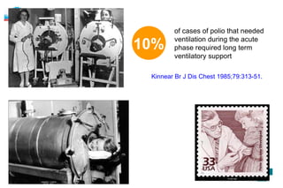 of cases of polio that needed ventilation during the acute phase required long term ventilatory support 10% Kinnear Br J Dis Chest 1985;79:313-51. 