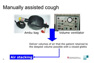 Manually assisted cough  Air stacking Deliver volumes of air that the patient retained to the deepest volume possible with a closed glottis Ambu bag Volume ventilator 