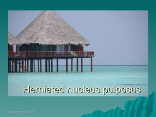 December 1, 2009 Herniated nucleus pulposus 