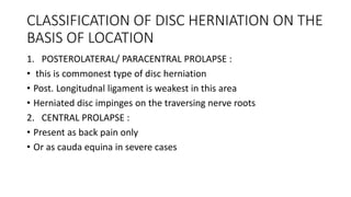 Disc Prolapse Classification Disc herniation | PPTX