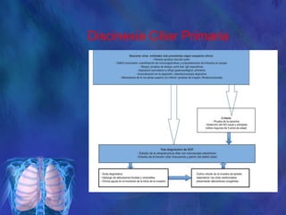 Discinesia Ciliar Primaria
 