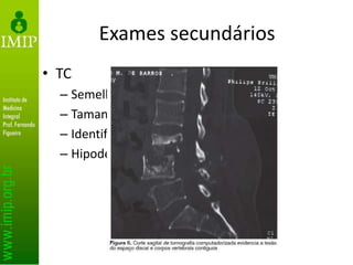 Exames secundários
• TC
– Semelhante ao RX
– Tamanho do canal vertebral
– Identifica edema e abscessos
– Hipodensidade do disco
 