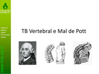 TB Vertebral e Mal de Pott
 