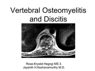 Vertebral Osteomyelitis
and Discitis
Rose-Krystel Hegngi MS 3.
Jayanth H.Keshavamurthy M.D.
 
