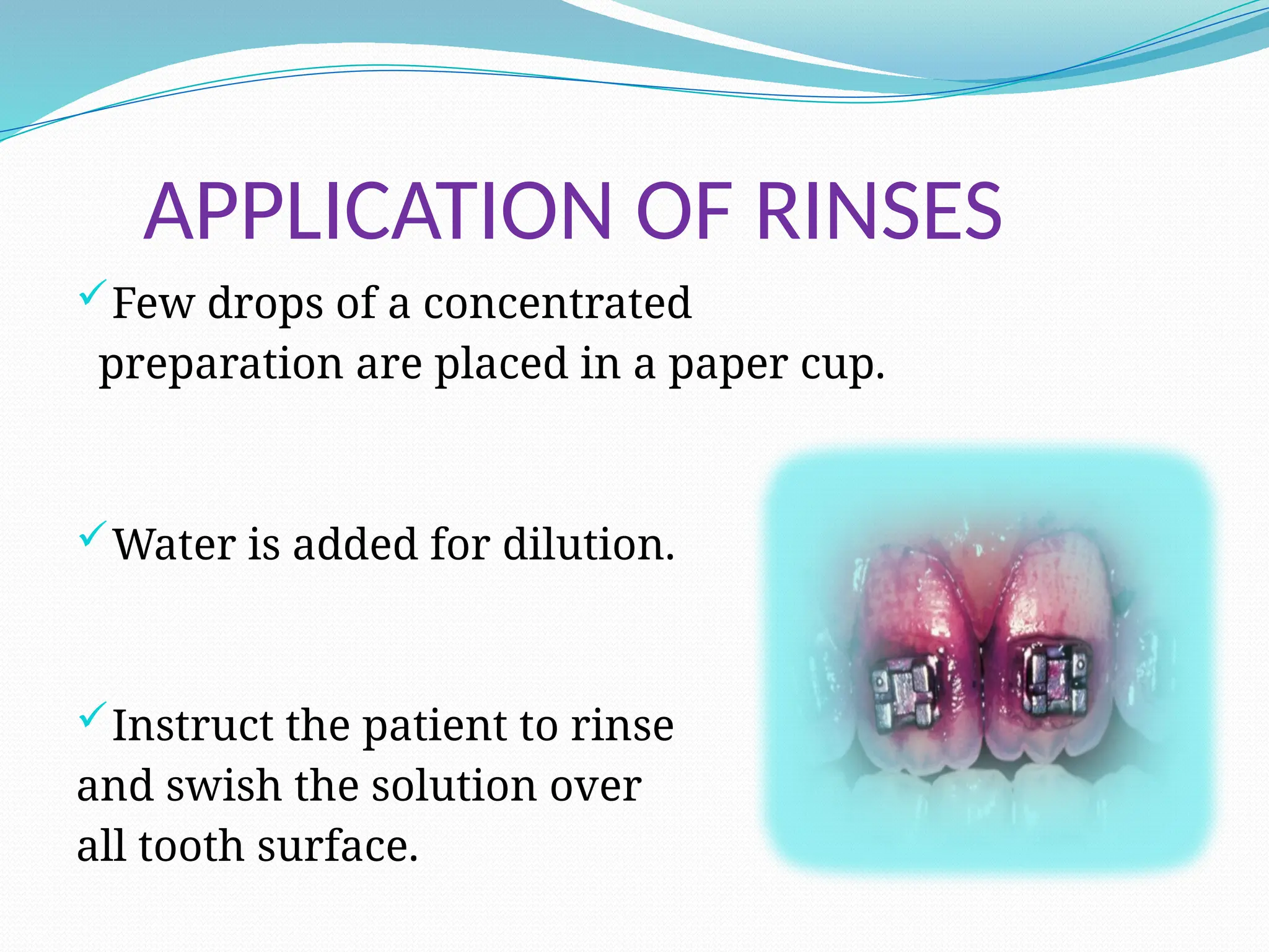 APPLICATION OF RINSES
Few drops of a concentrated
preparation are placed in a paper cup.
Water is added for dilution.
Instruct the patient to rinse
and swish the solution over
all tooth surface.
 