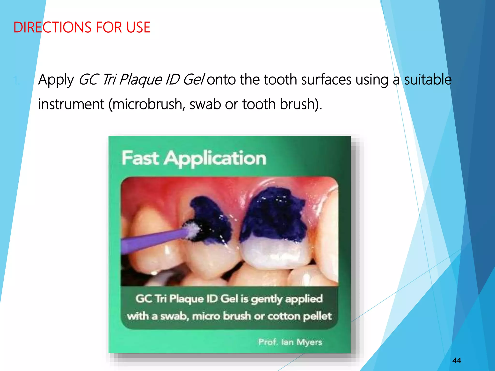 DIRECTIONS FOR USE
1. Apply GC Tri Plaque ID Gel onto the tooth surfaces using a suitable
instrument (microbrush, swab or tooth brush).
44
 