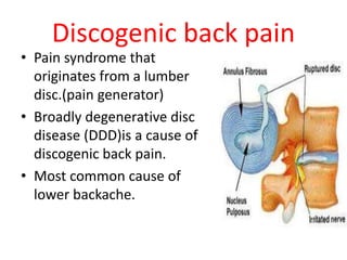 Discogenic lower backache by DR.NAVEEN RATHOR | PPTX