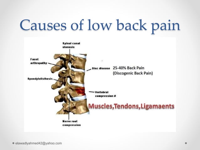 Discogenic low back pain | PPTX