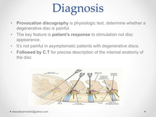 Discogenic low back pain | PPTX