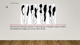 Diagnostic & Therapeutic Updates of Discogenic Low Back Pain | PDF