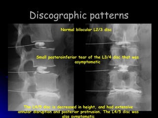 Discography (SPINE 2008) | PPT