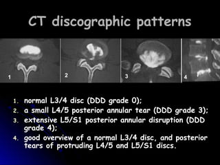 Discography (SPINE 2008) | PPT