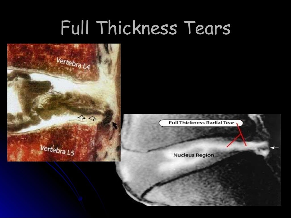 Discography (SPINE 2008)