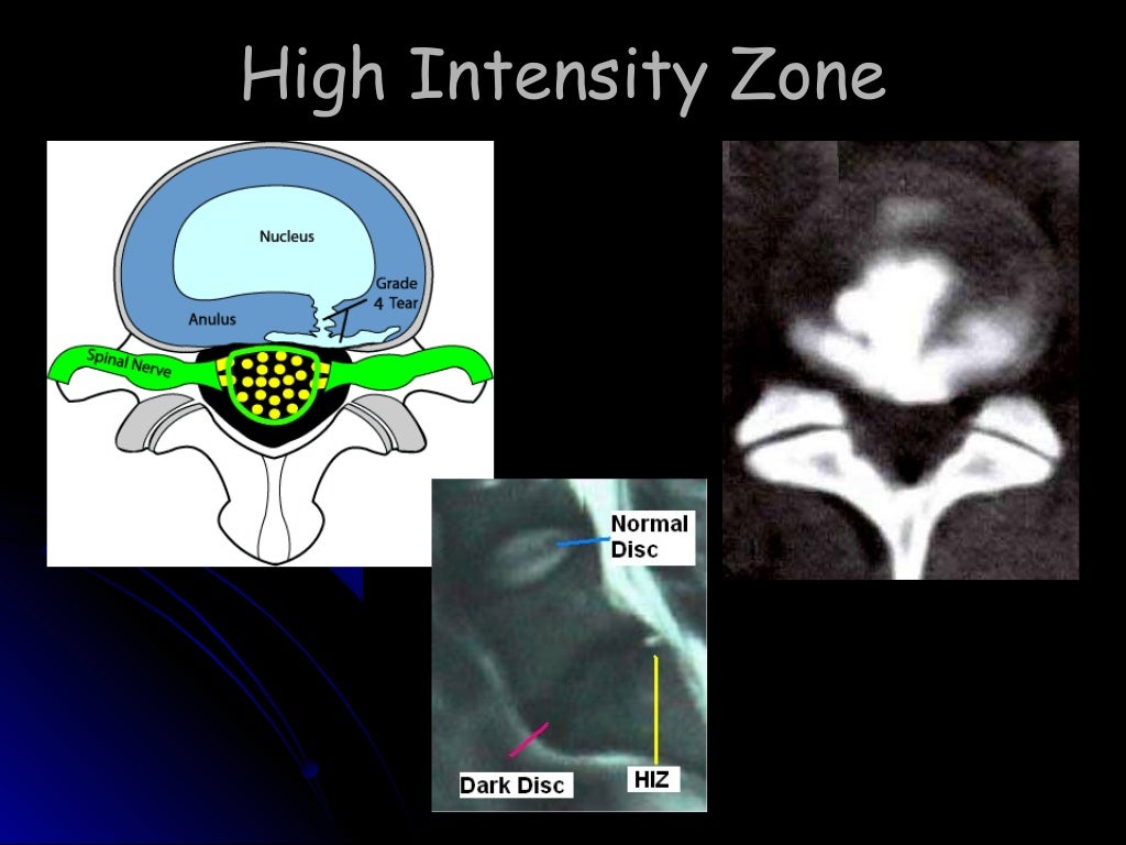 Discography (SPINE 2008)