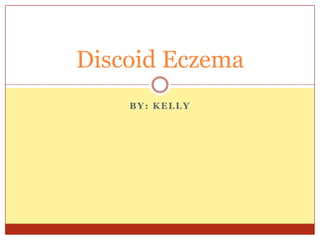 BY: KELLY
Discoid Eczema
 