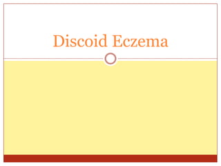Discoid Eczema
 