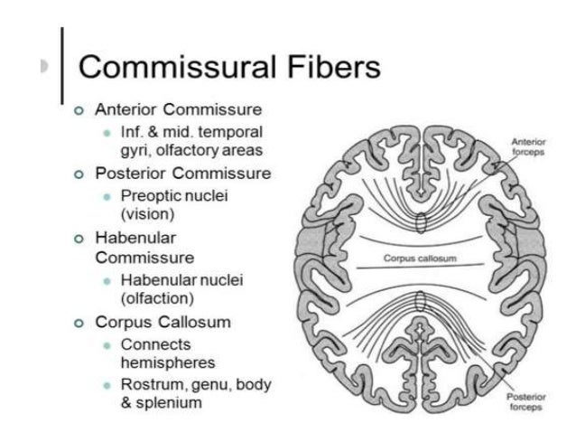 Image result for commissural fibres