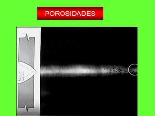 POROSIDADES
 
