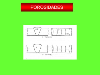 POROSIDADES
 